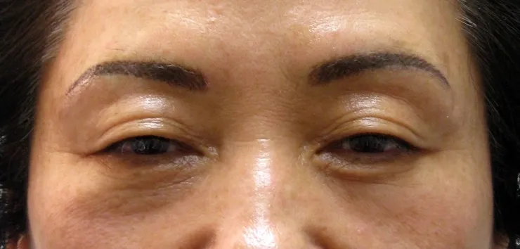 After correction, client 10