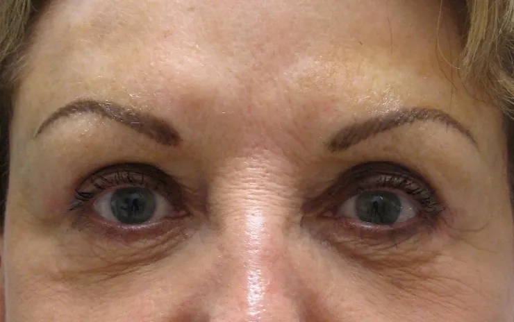 After correction, client 4