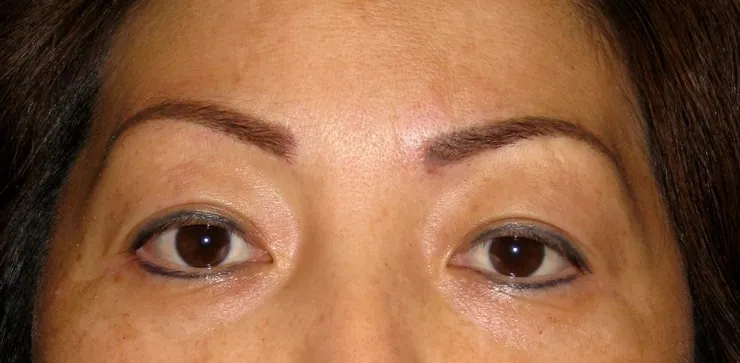 After correction, client 6