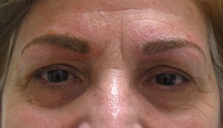 After correction, client 8