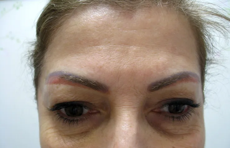Before correction, client 1