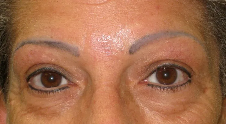 Before correction, client 5