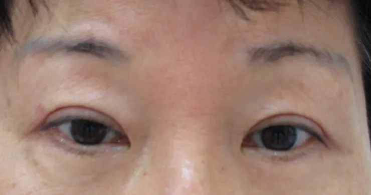 Before correction, client 7